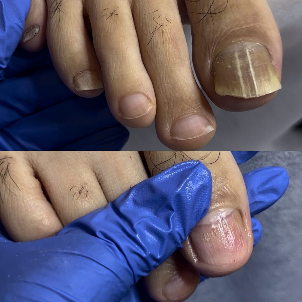 Paramedical Pedicure 2