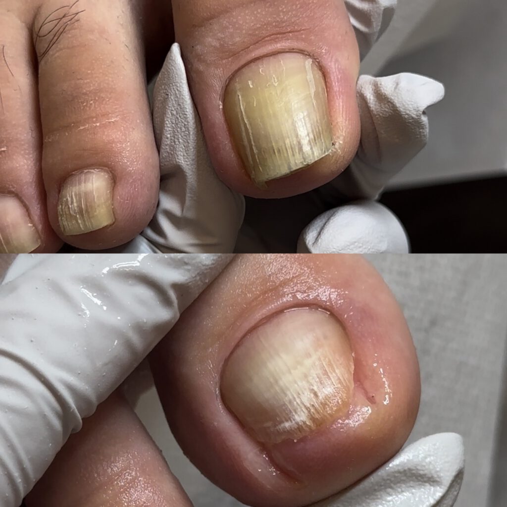 Paramedical Pedicure 3