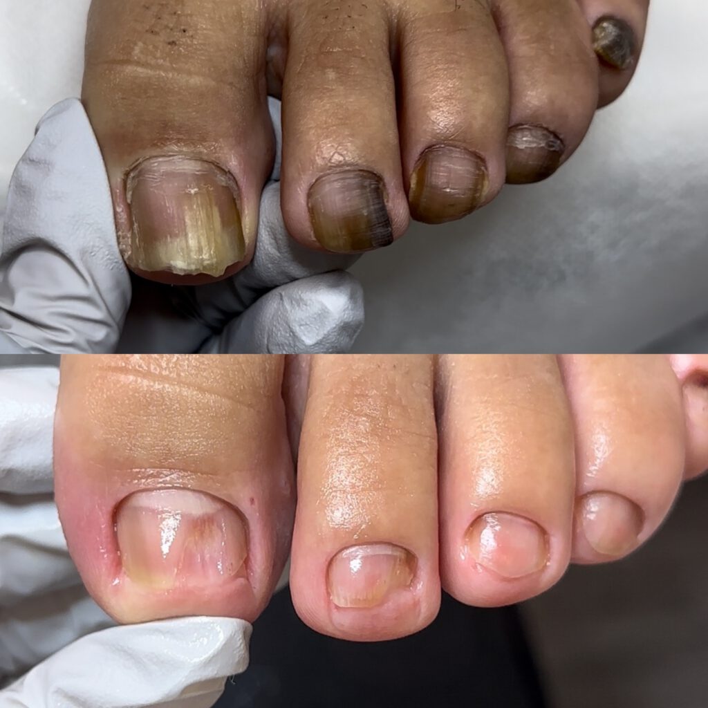 Paramedical Pedicure 8