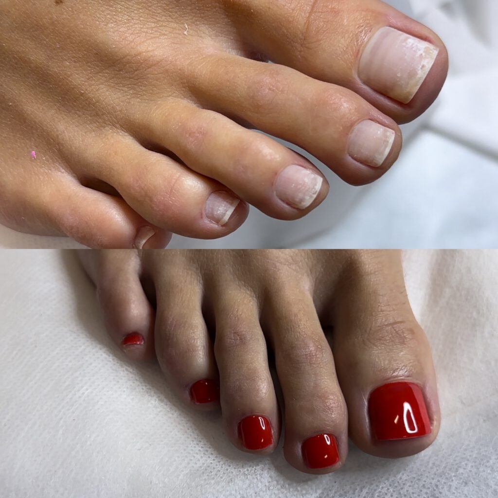 Smart Dry Pedicure & Gel Overlay 1