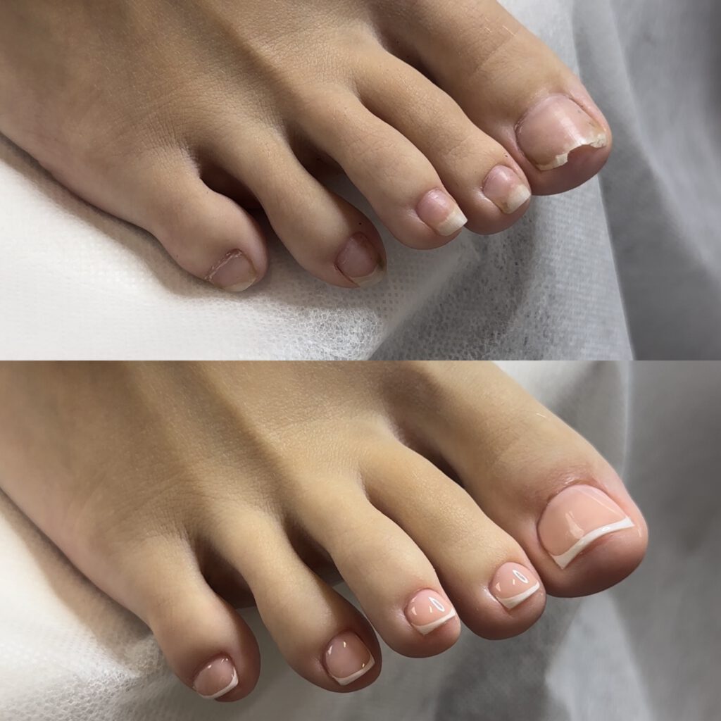 Smart Dry Pedicure & Gel Overlay 3